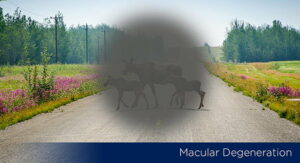 Cataracts Maine